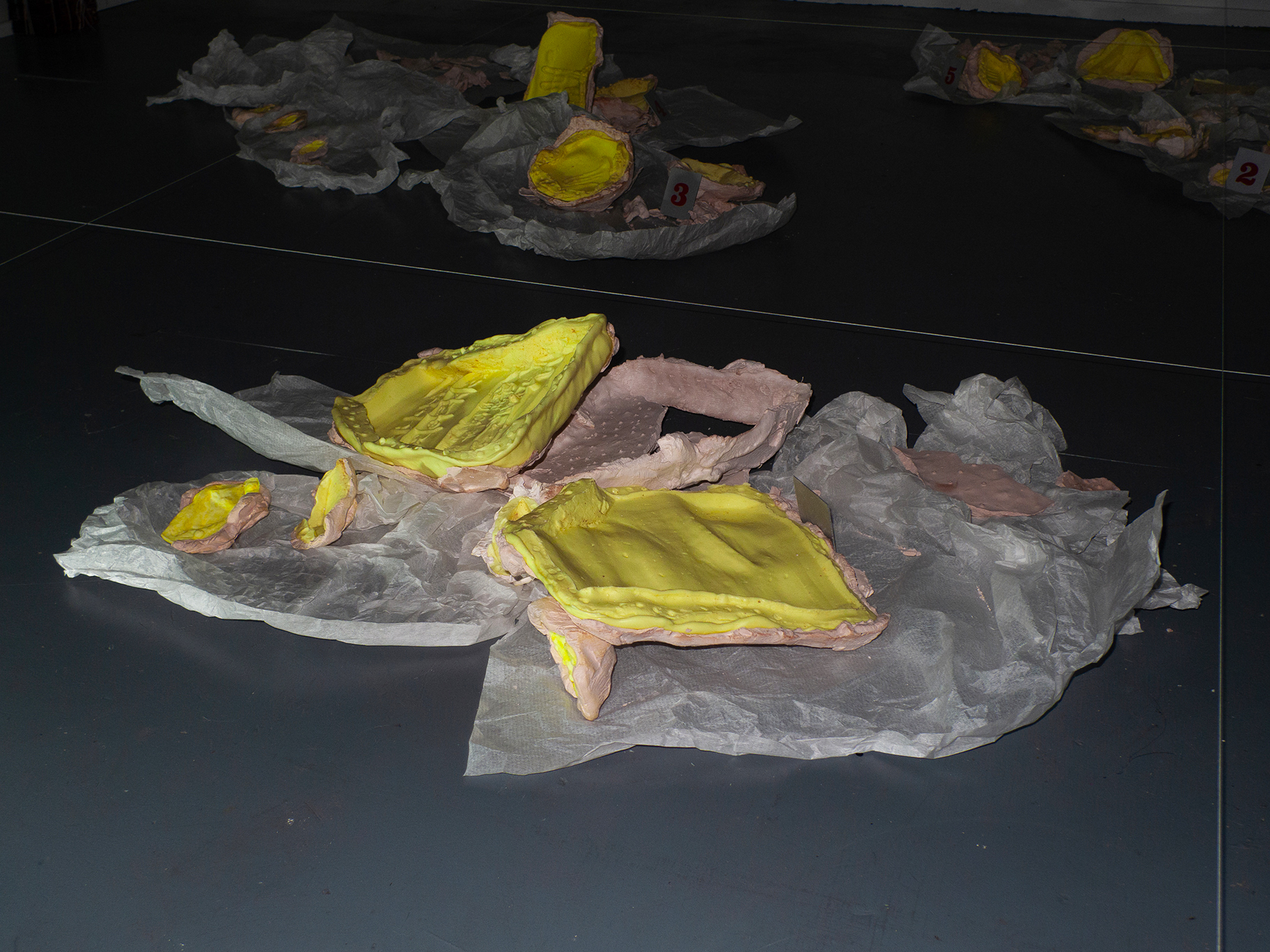 Repatriation (Detail)